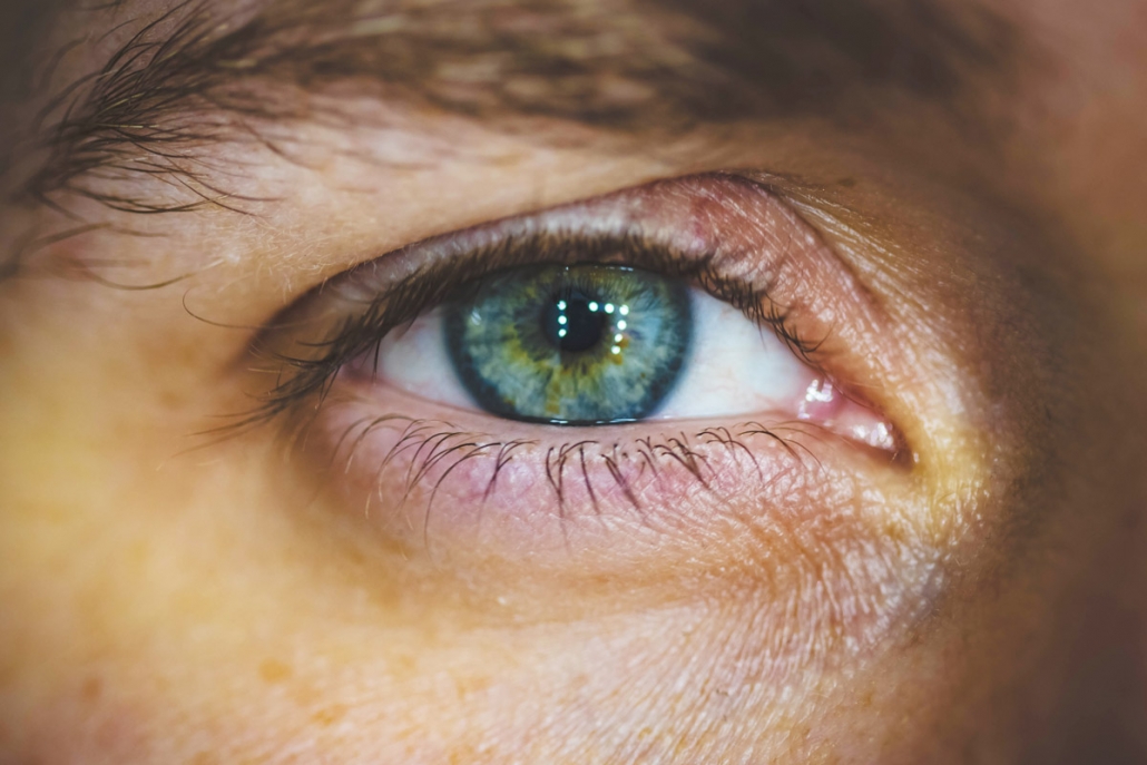 Sindrome Dell Occhio Secco Curiosit E Falsi Miti Cios